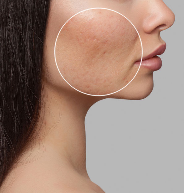 woman with scars on cheek